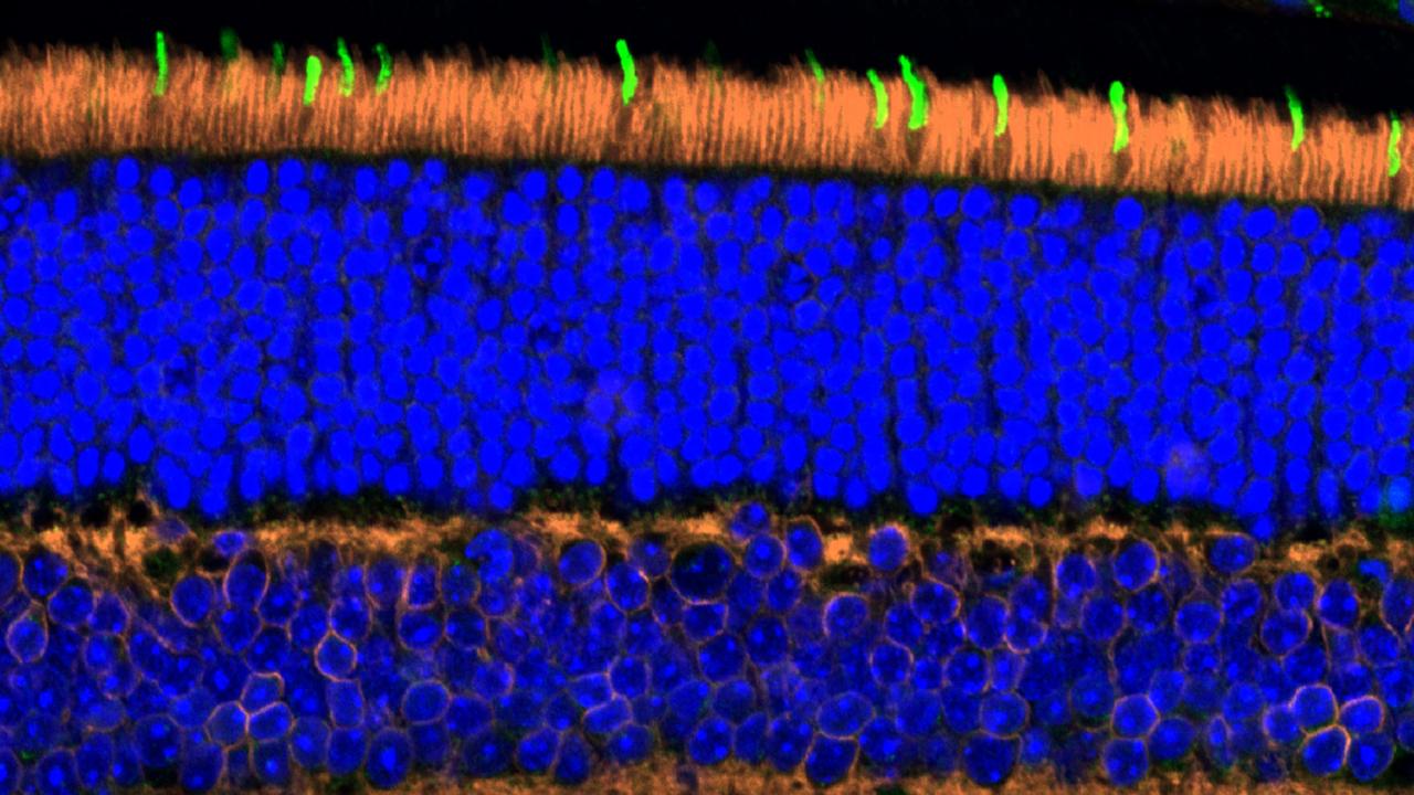 Neural micrograph in vivid blue and orange