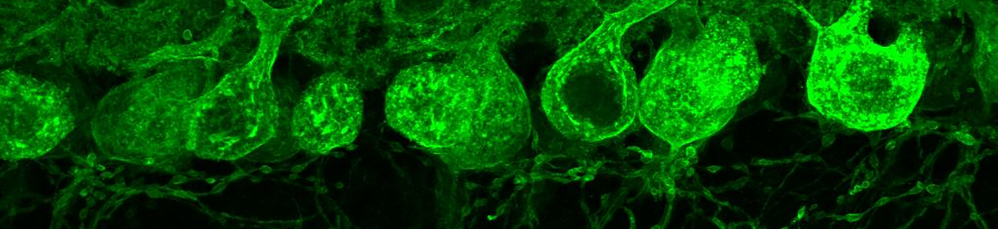 A green and black micrograph of neurological tissue
