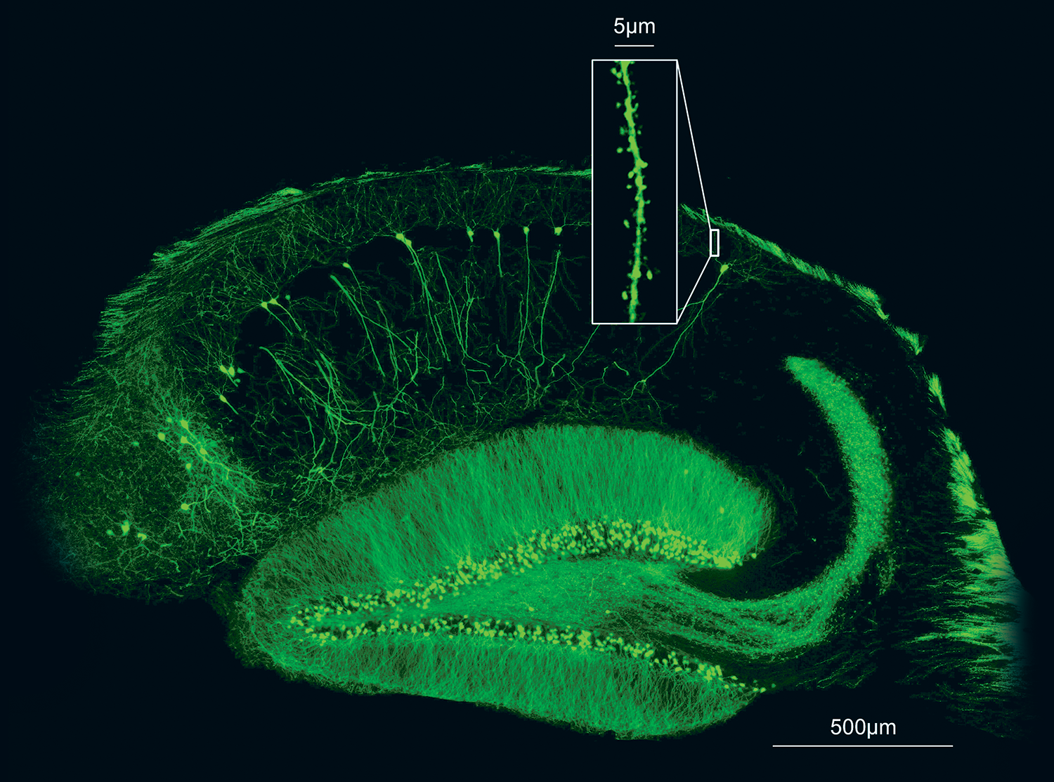 Picture of a brain