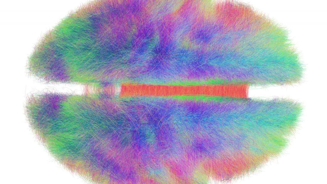 picture of the mapping of the brain pathways