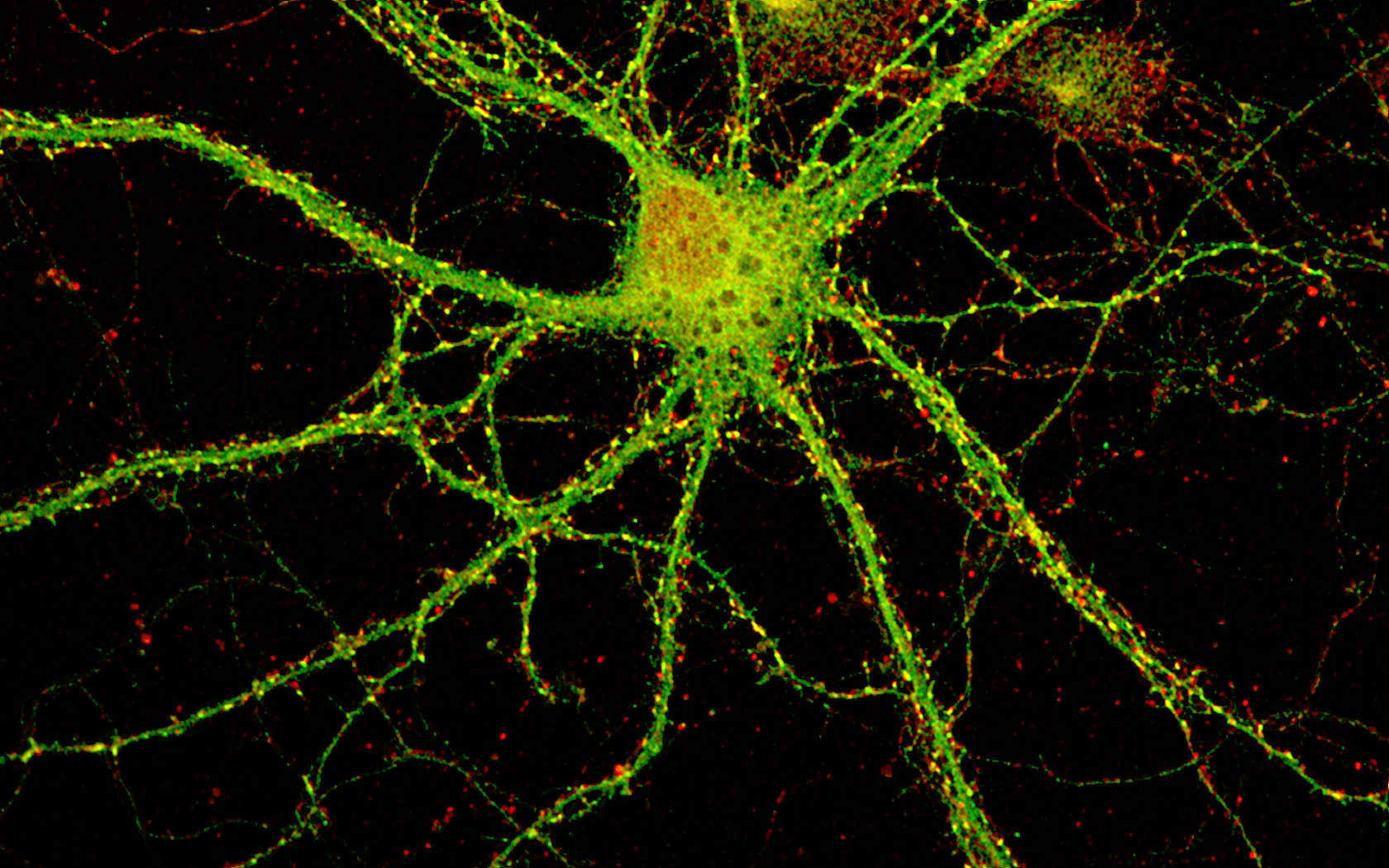 picture of a neuron